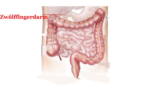 Zwölffingerdarm